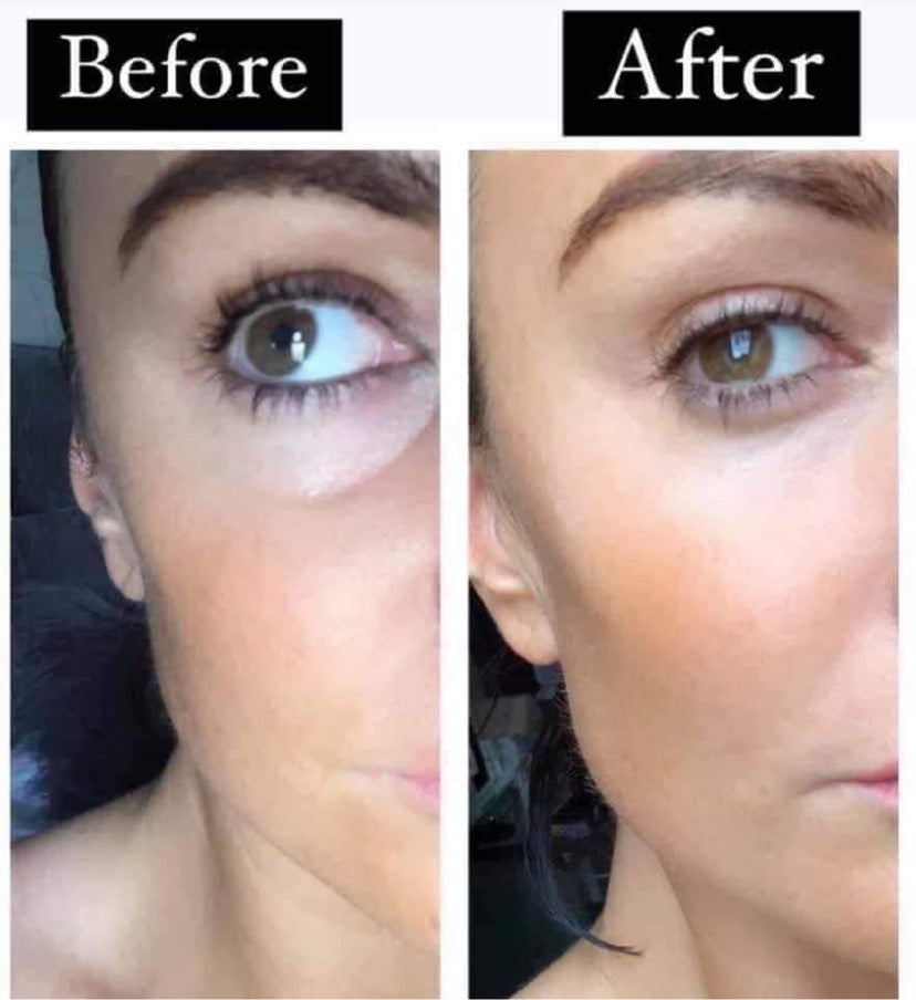 Before and after results of Fontainavie Complex Eye Serum application on eye area.